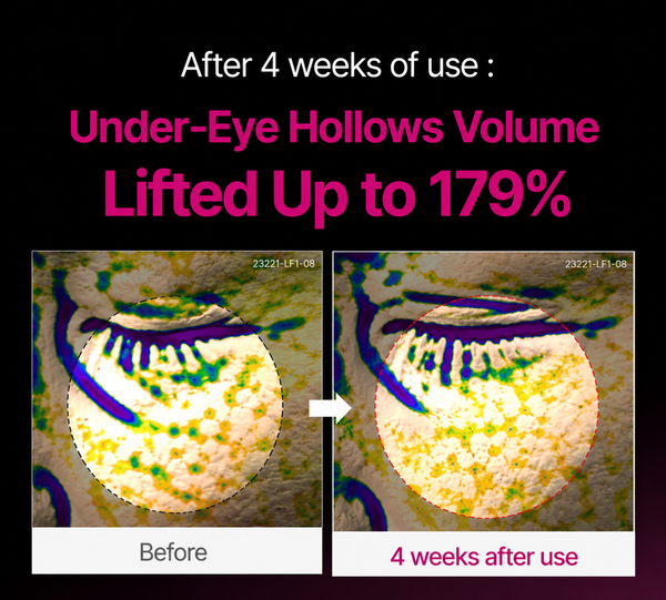 Prisolite Korean Calcium Eye Cream | Dark Spots, Dark Circles & Pigmentation